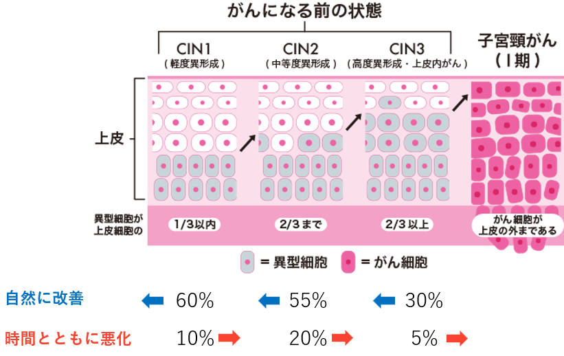 異形成と子宮頸癌