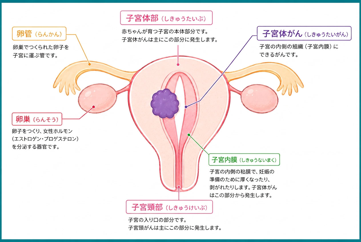 子宮体がんのイラスト