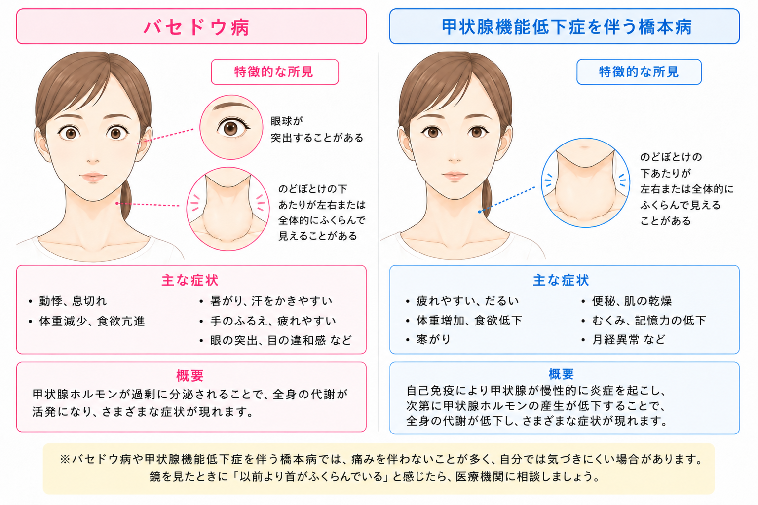 バセドウ病と橋本病の症状と概要
